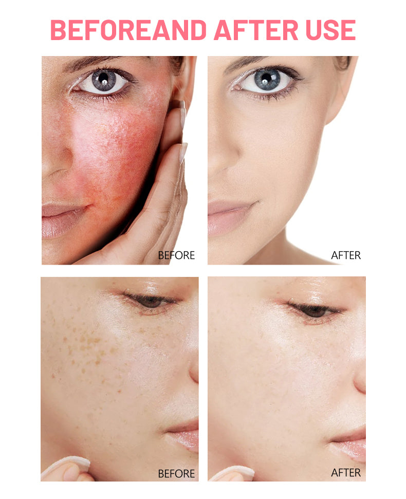 Kit Facial Rose Ceramide 5 Piezas Premium Pack